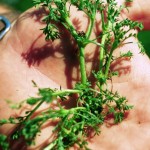 Lawn burweed